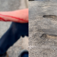 Herido tras sufrir una caída en una calle en mal estado de Badajoz