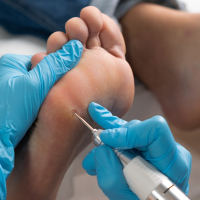 El SES incorpora podólogos y refuerza sus programa de Cuidados Paliativos