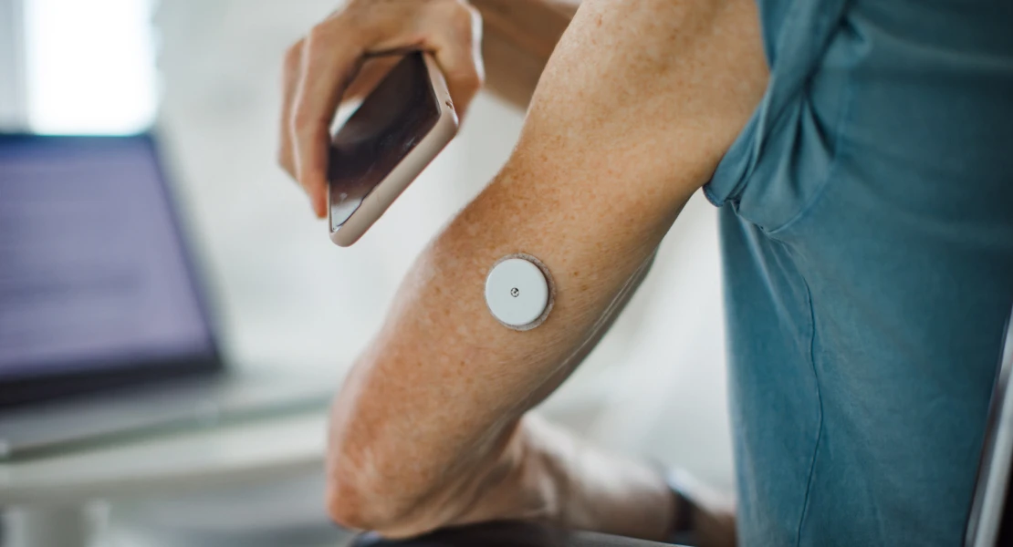 Sanidad retira un sensor y transmisor de glucosa tras varios incidentes