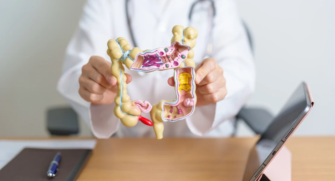 9 de cada 10 personas sobrevivirían al cáncer de colon si se detectara a tiempo