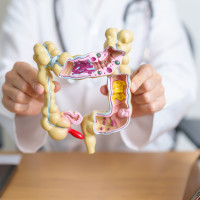 9 de cada 10 personas sobrevivirían al cáncer de colon si se detectara a tiempo