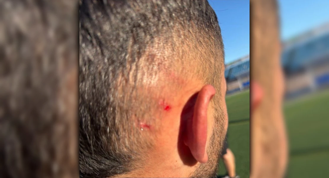 El CD Badajoz condena la agresión de un aficionado contrario a su jugador Bermu