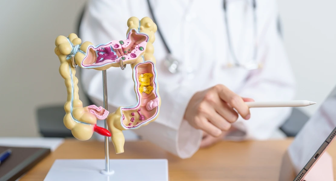 “Solo cuatro de cada diez personas acuden a su cita del cribado de cáncer colorrectal”