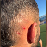 El CD Badajoz condena la agresión de un aficionado contrario a su jugador Bermu