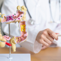 “Solo cuatro de cada diez personas acuden a su cita del cribado de cáncer colorrectal”