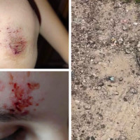 Un menor sufre lesiones debido al mal estado de las calles del Cerro de Reyes