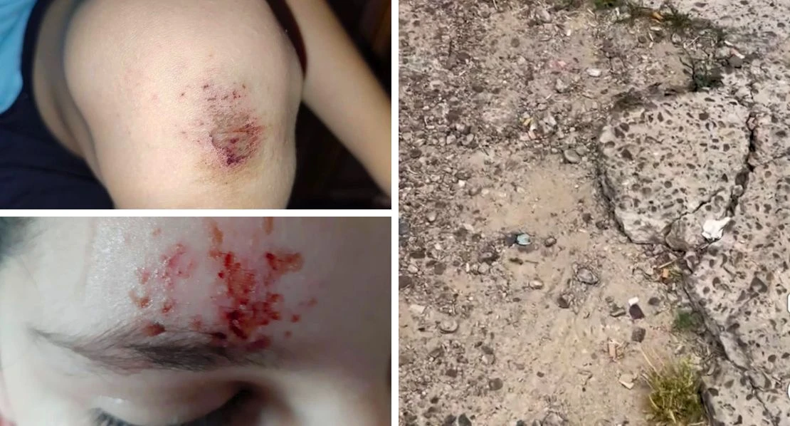 Un menor sufre lesiones debido al mal estado de las calles del Cerro de Reyes
