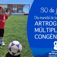 Día Mundial de la Artrogriposis, una enfermedad rara que busca dejar de ser desconocida