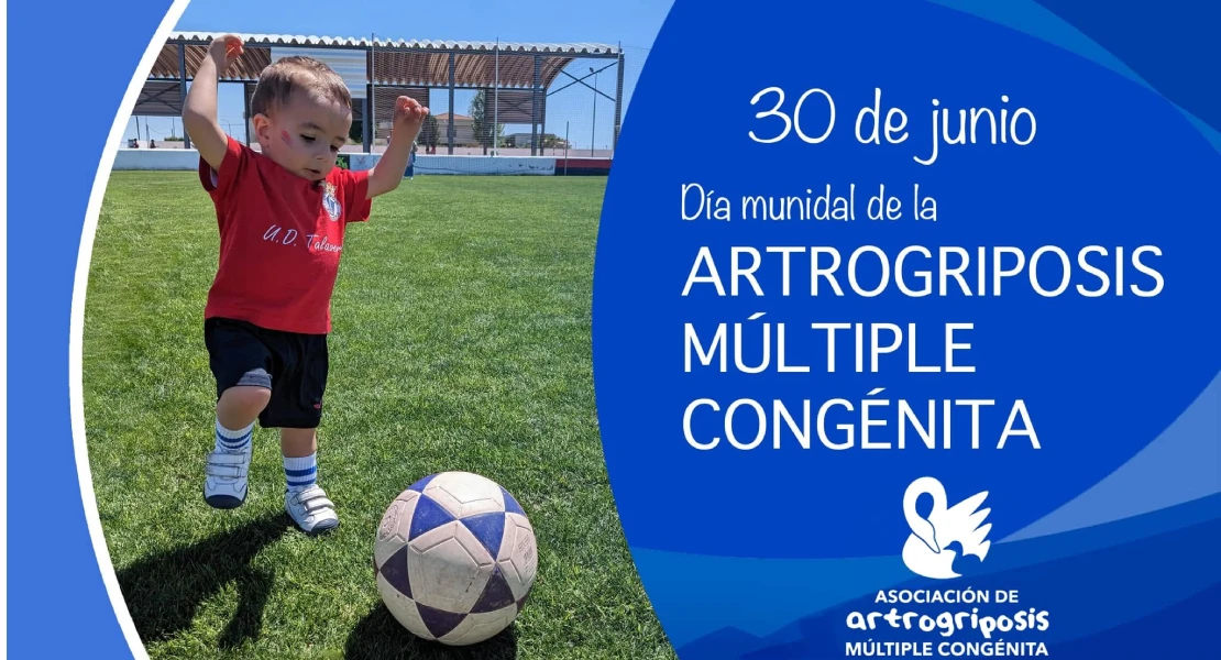 Día Mundial de la Artrogriposis, una enfermedad rara que busca dejar de ser desconocida