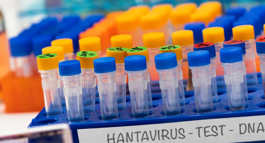 Sanidad confirma un caso de hantavirus en España en un turista procedente de Francia