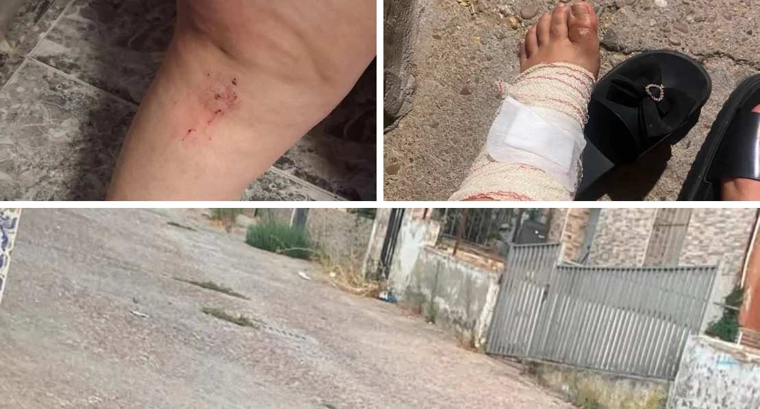Acaba con lesiones tras caerse en una calle de Badajoz
