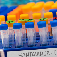 Sanidad confirma un caso de hantavirus en España en un turista procedente de Francia
