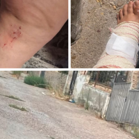 Acaba con lesiones tras caerse en una calle de Badajoz