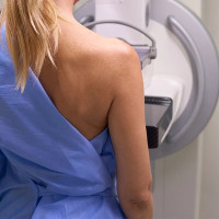 Más de 7.000 extremeñas se realizarán mamografías en octubre