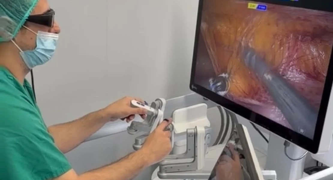 El Hospital Universitario de Cáceres realiza la primera cirugía robótica de pared abdominal